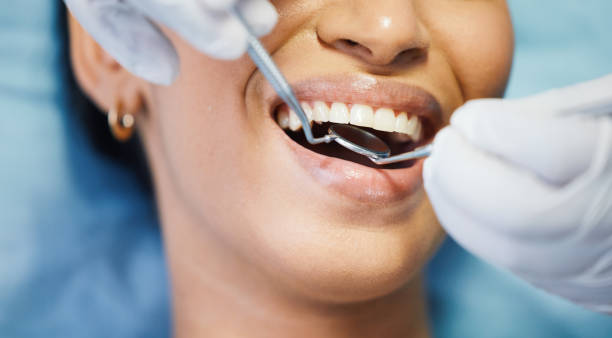 Best Emergency Denture Repair in Allen Park, MI