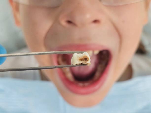 Best Emergency Gum Treatment in Allen Park, MI