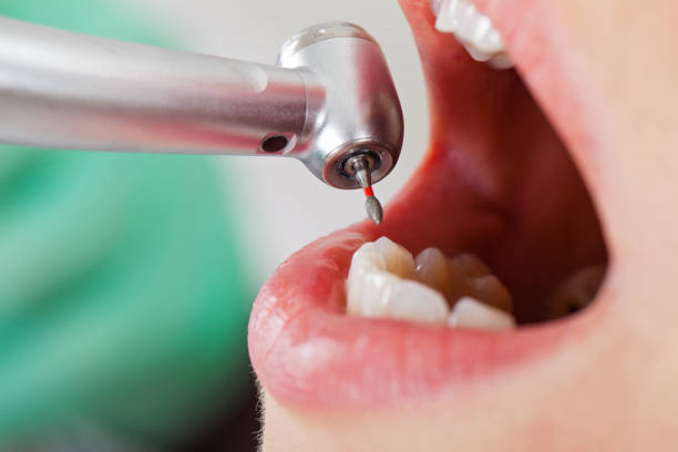 Best Emergency Gum Treatment in Allen Park, MI